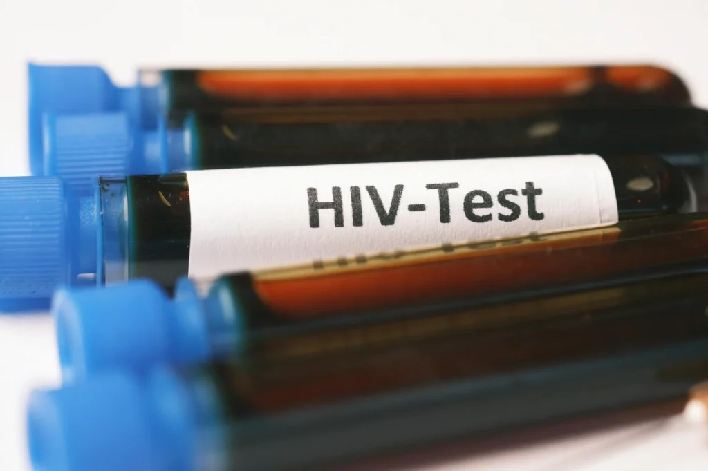 HIV Nedir?