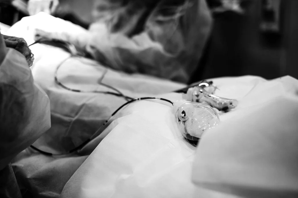 Aort Yırtılması (Aort Diseksiyonu) Nedir?