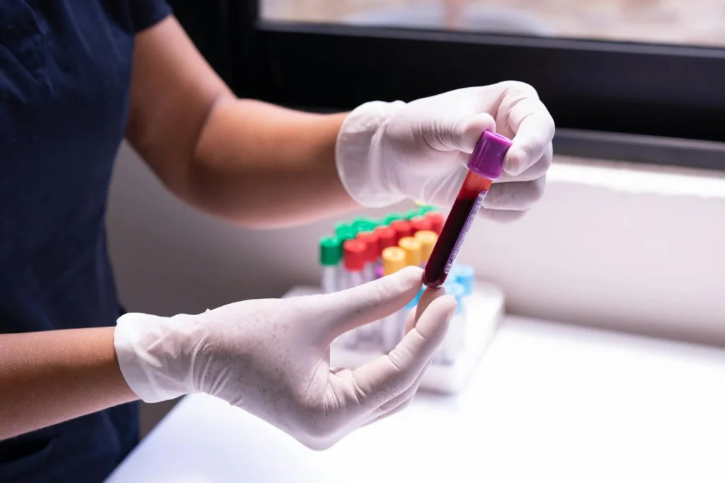 STATIN Nedir?