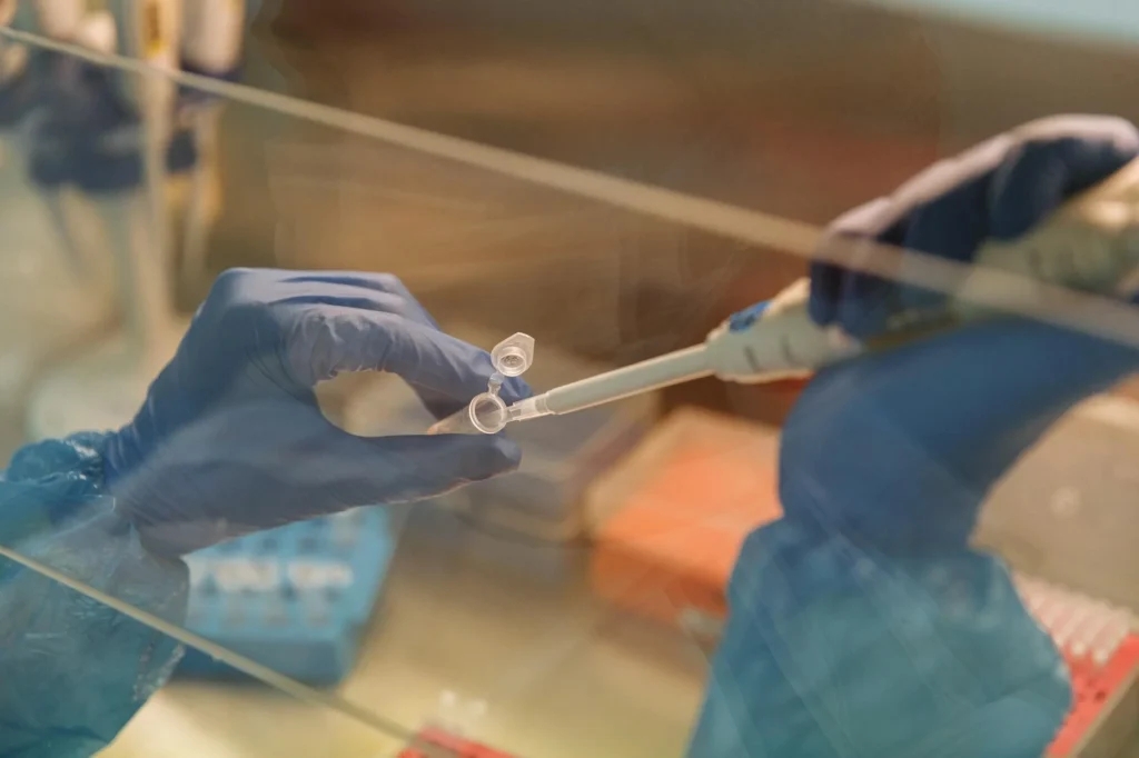 Mukolipidoz Nedir?