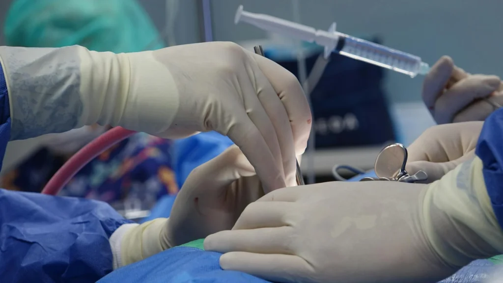 Epidural İğnesi Nedir?