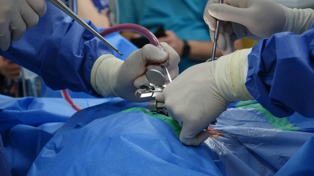 Epidural İğnesi Nedir?