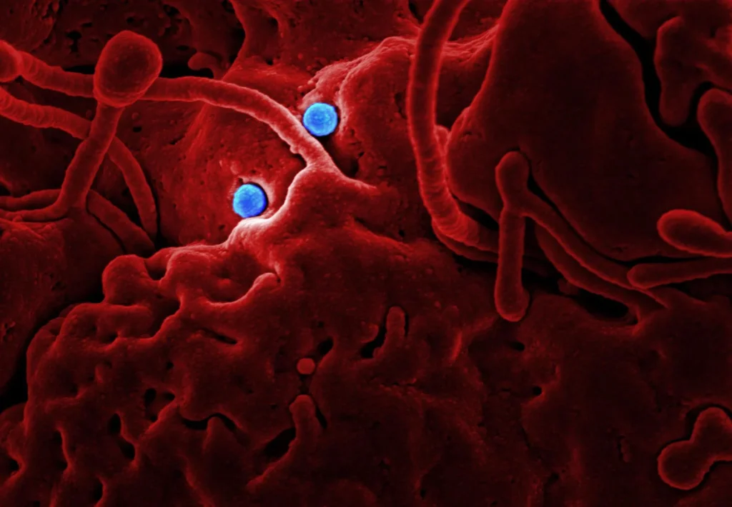 Ebola Virüsü Nedir?
