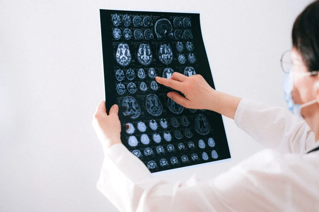 Frontotemporal Demans (FTD) Nedir?