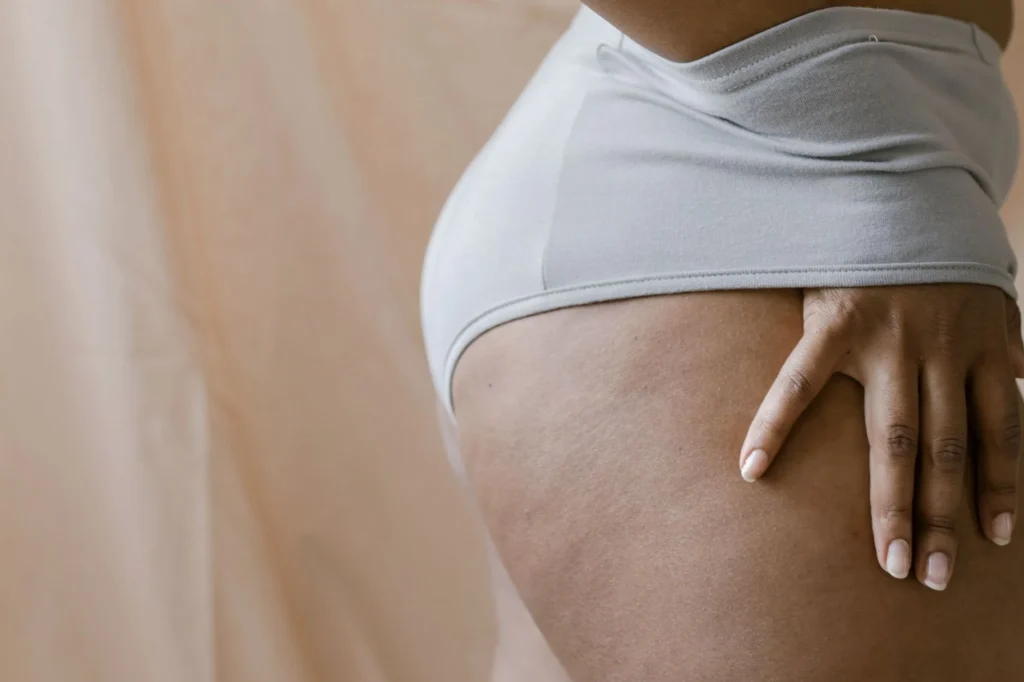 Kalça Çukurları (Hip Dips) Nedir?