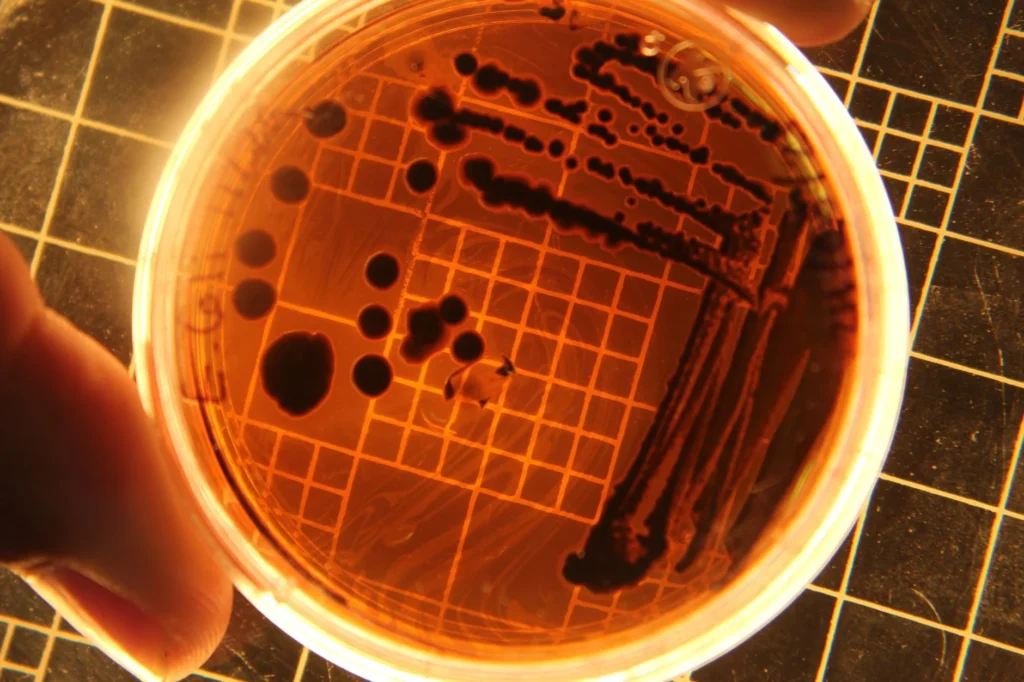 Koli Basili (E. coli) Nedir?