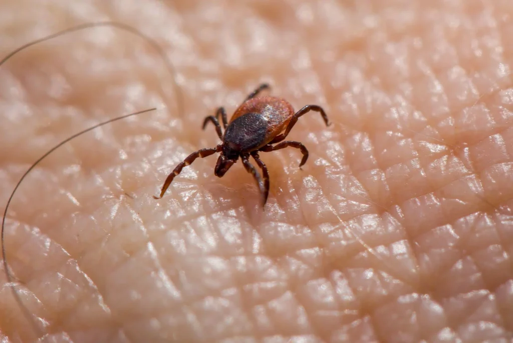 Lyme Hastalığı Nedir?