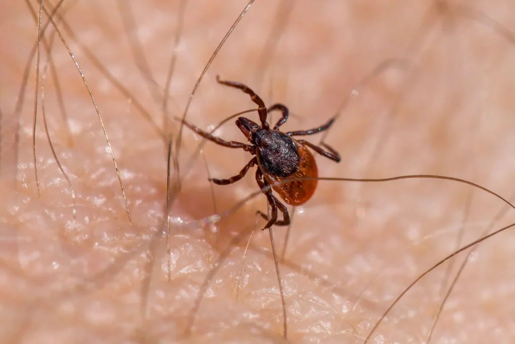Lyme Hastalığı Nedir?