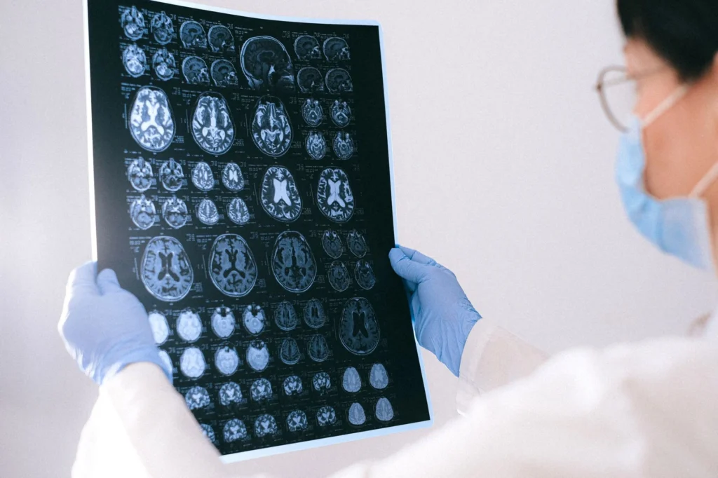 Frontotemporal Demans (FTD) Hastalığı Nedir?