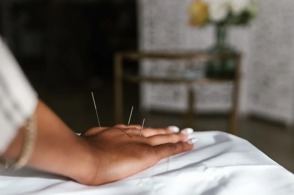Akupunktur Nedir?