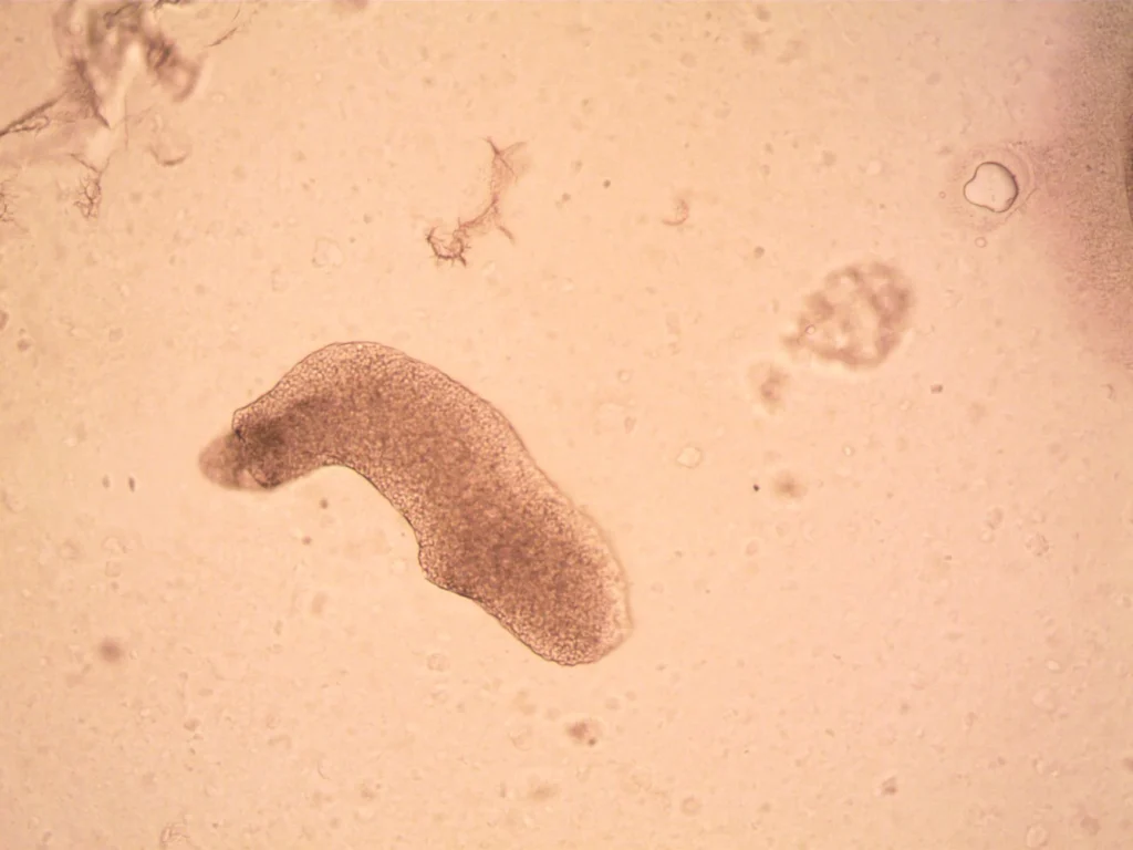 Diatom Testi Nedir?