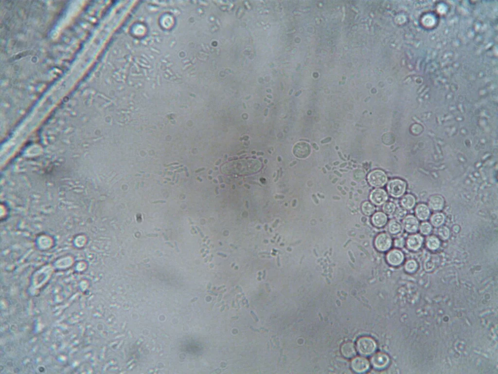 Diatom Testi Nedir?