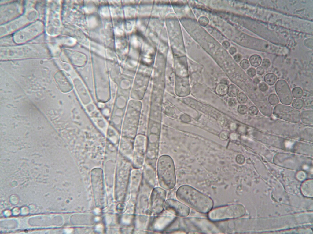 Koli Basili (E. coli) Nedir?