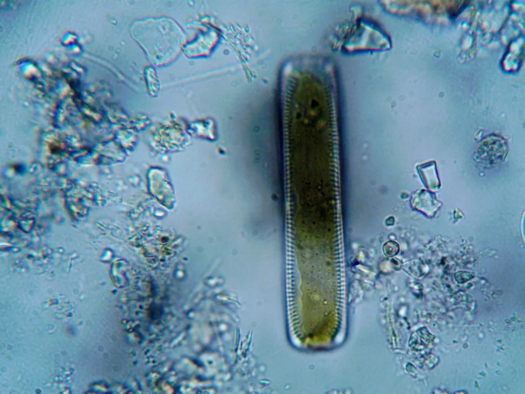 Diatom Testi Nedir?