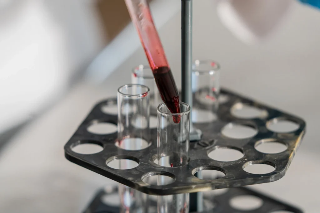 Laktat Testi Nedir?
