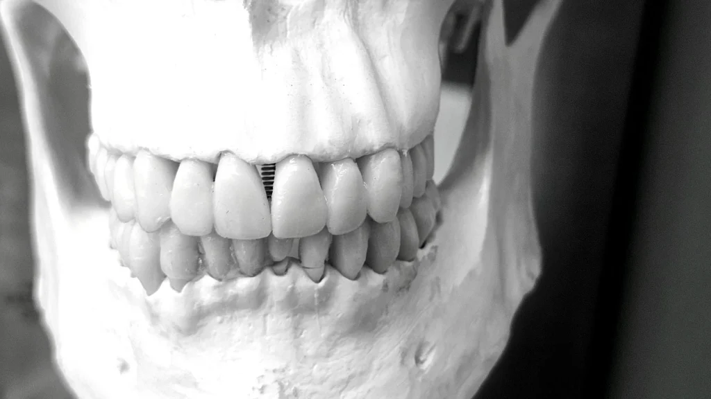Pense Kemiği" Olarak Bilinen Alt Çene Kemiği (Mandibula) Nedir?