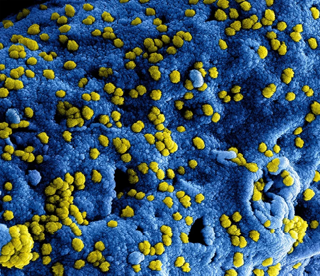 EBOLA Nedir?