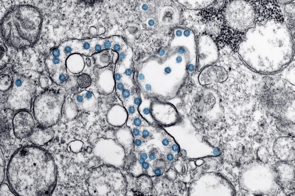 EBOLA Nedir?