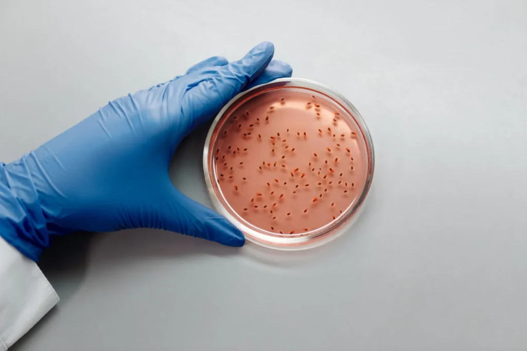 Listeria Nedir?